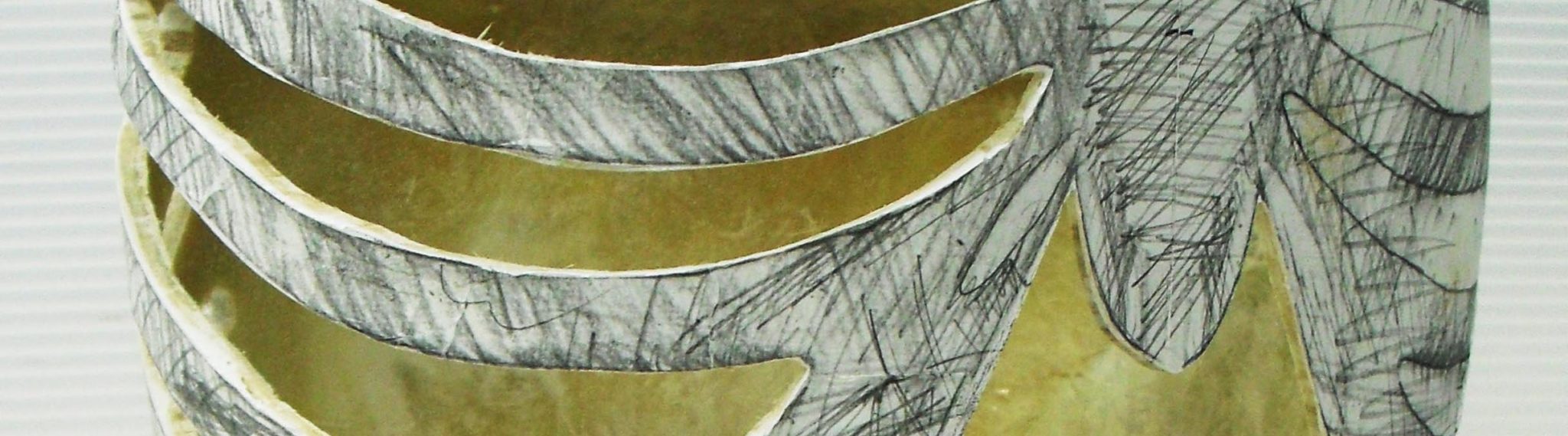 Echo-guided RFA puncture phantom for liver tumor – ユー・エー株式会社